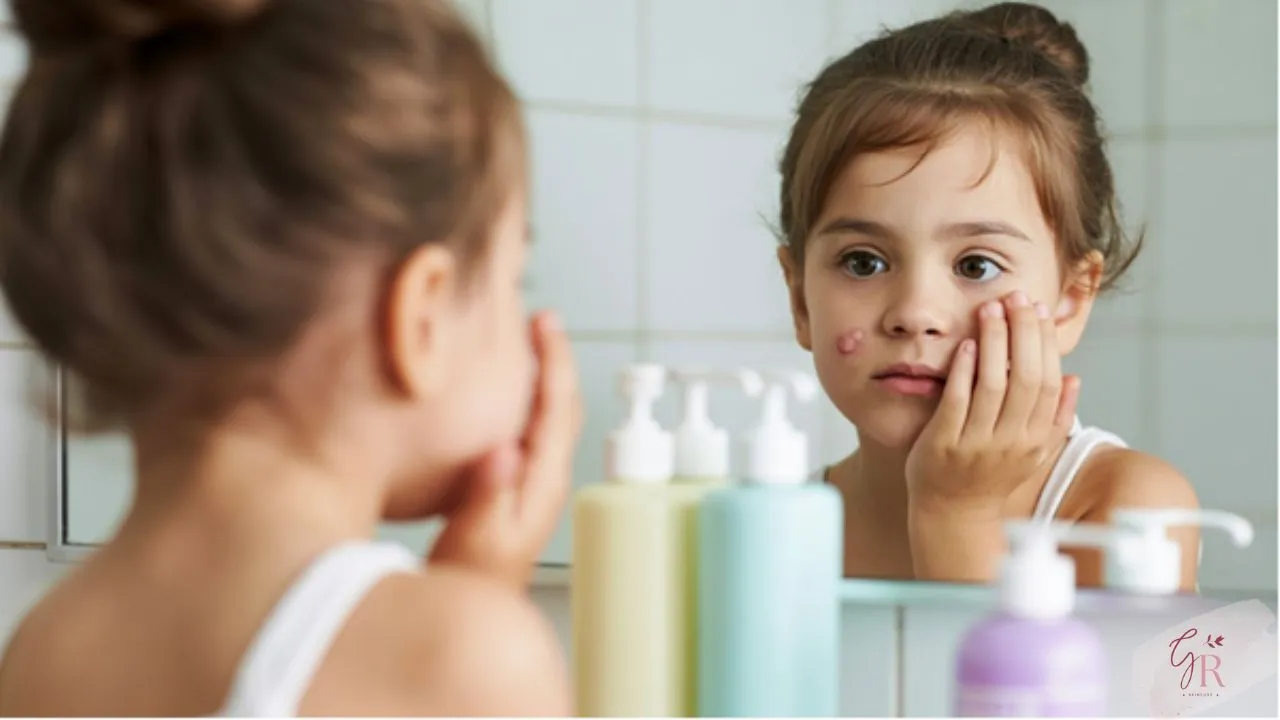 A young child looking in the mirror with early signs of acne on the face, symbolizing kids' skincare awareness